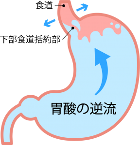 isyokudougyakuryu