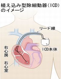 jyosaidouki