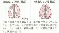 bicyukakuwankyoku