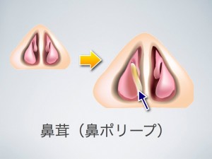 hanatake