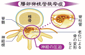 sekicyukan