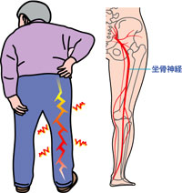 zakotsushinkeitsu1