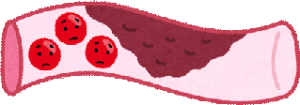 doumyakukouka-kessen