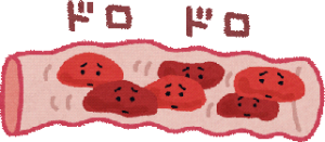 doumyakukouka-kijyunti